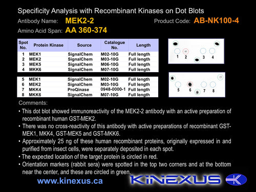 AB-NK100-4P