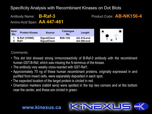 AB-NK156-4P