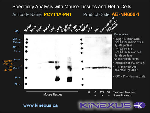 AB-NN606-1