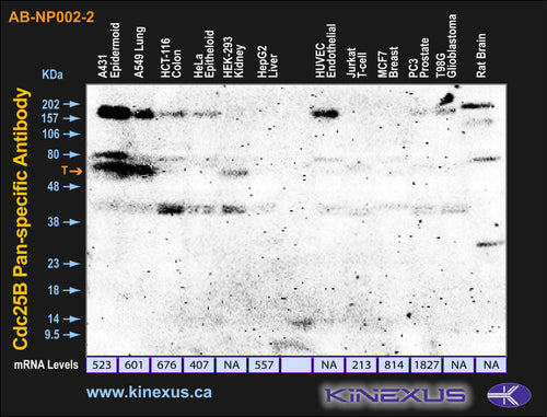 AB-NP002-2P