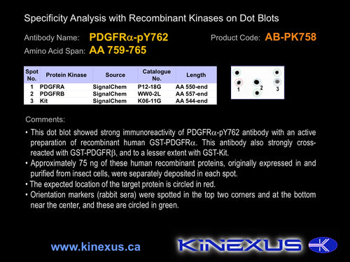 AB-PK758