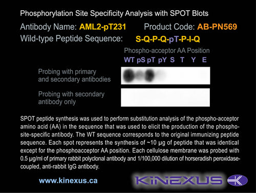 AB-PN569