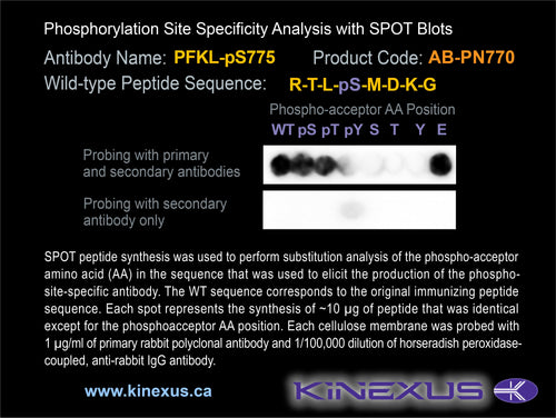 AB-PN770