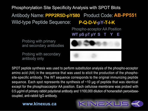 AB-PP551